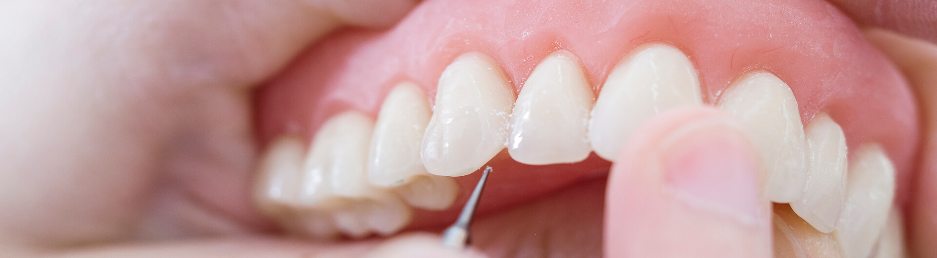dentist creating custom dentures