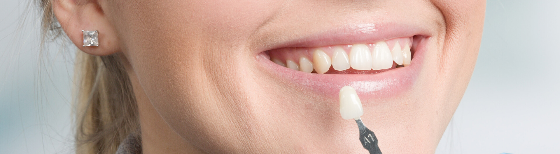 Woman smiling with a dental veneer held up