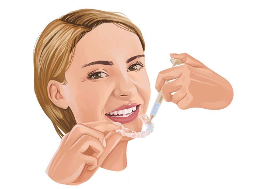 woman using kor teeth whitening treatment