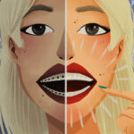 braces vs clear aligners